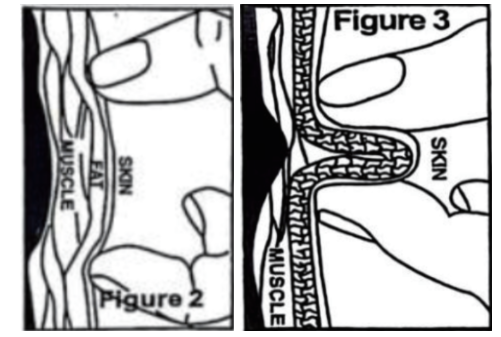 obrázek 2 in 3 - tukový kaliper